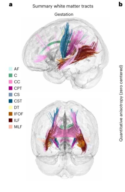 Ilustração de trajetos da substância branca no cérebro durante a gestação